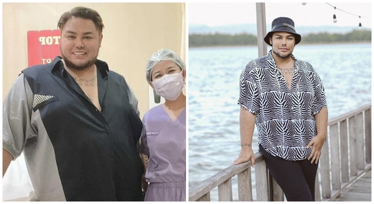 potret dulu dan kini seleb obesitas © berbagai sumber potret dulu dan kini seleb obesitas © berbagai sumber