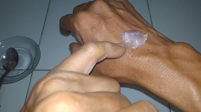 Tanpa jarum atau air hangat, ini trik mengeluarkan duri ikan di tangan pakai 1 bahan dapur