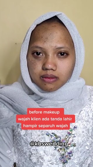 manten Sunda tanda lahir di muka © 2023 brilio.net