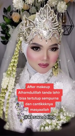 manten Sunda tanda lahir di muka © 2023 brilio.net