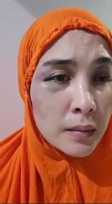 wanita korban KDRT malah jadi tersangka Twitter wanita korban KDRT malah jadi tersangka Twitter