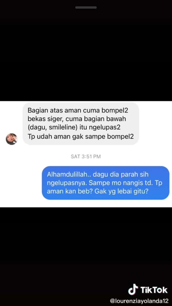 makeup pengantin berjerawat © TikTok makeup pengantin berjerawat © TikTok