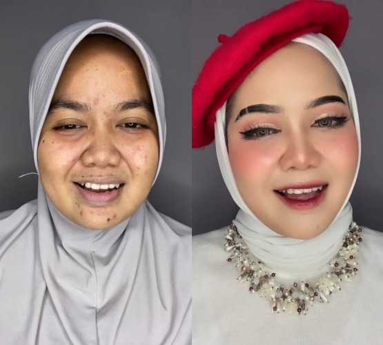 Wanita berjerawat ini auto mulus © TikTok