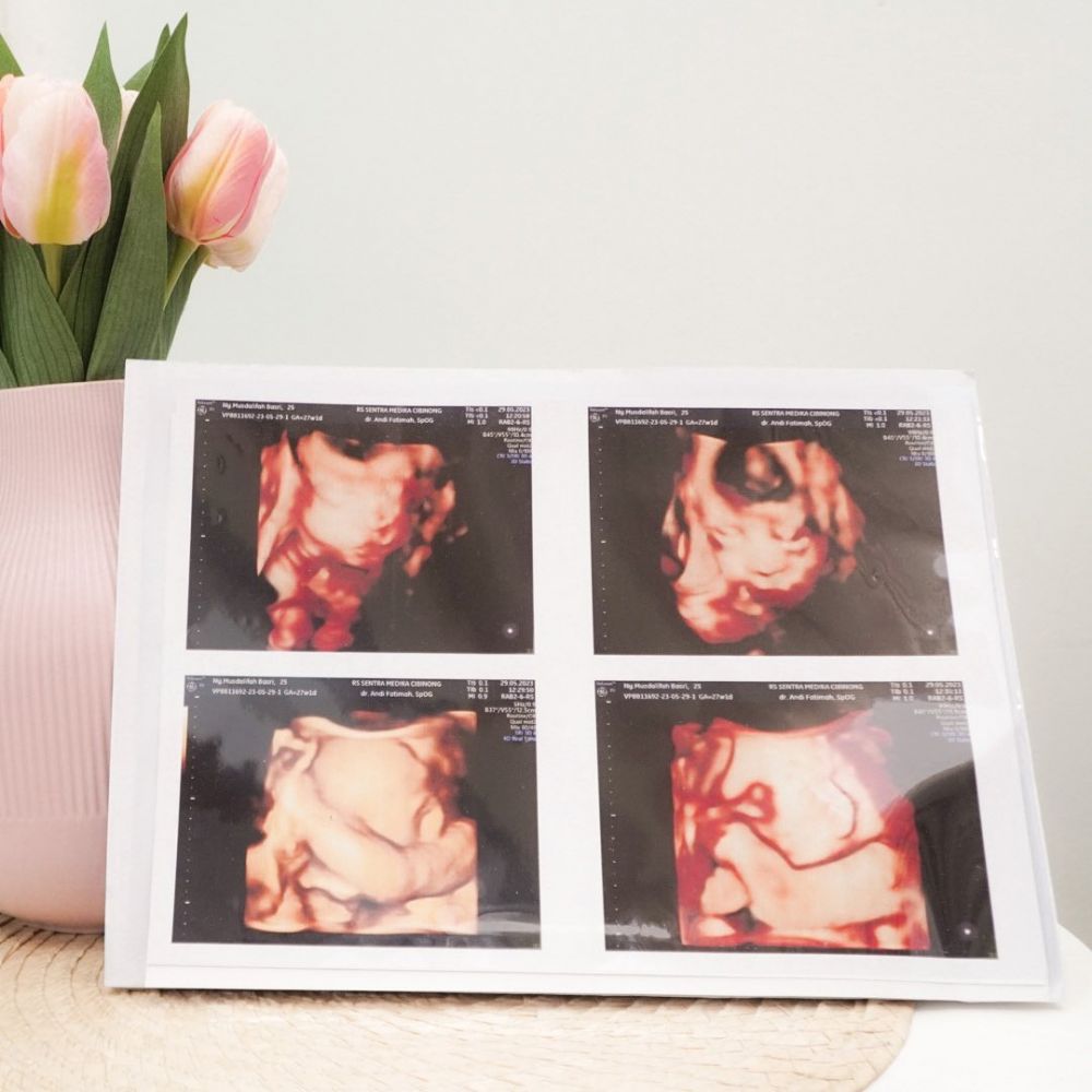 duka musdalifah basri kehilangan anak kembar © instagram