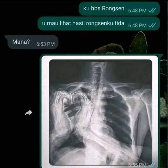 Gombal bikin auto geli Berbagai sumber