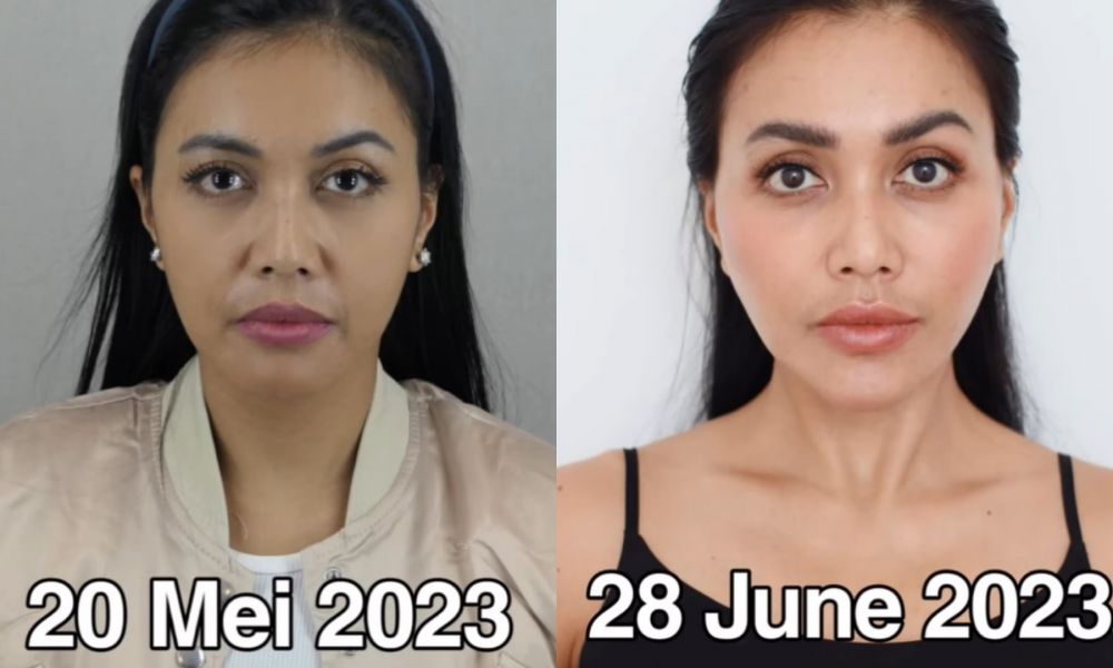 potret seleb sebelum dan sesudah oplas © berbagai sumber