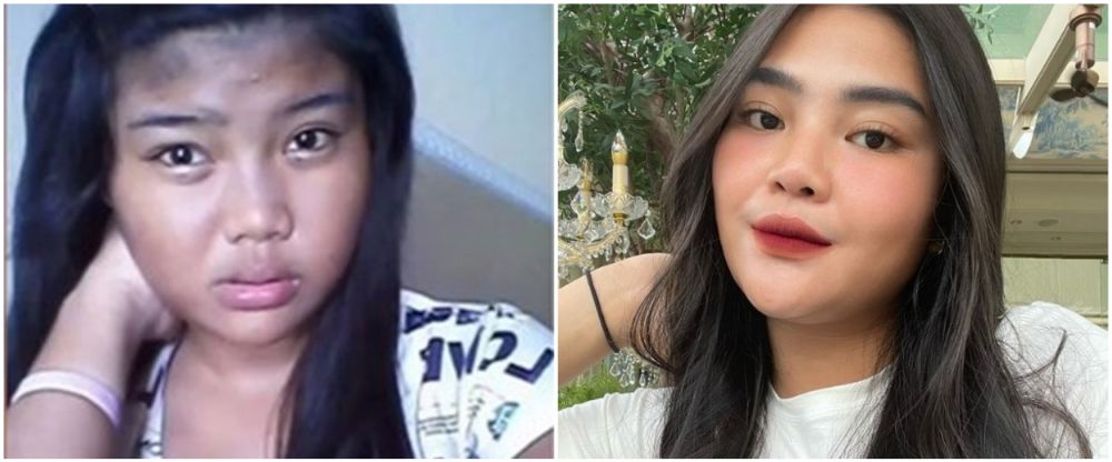 dulu dan kini Rosa Meldianti © berbagai sumber