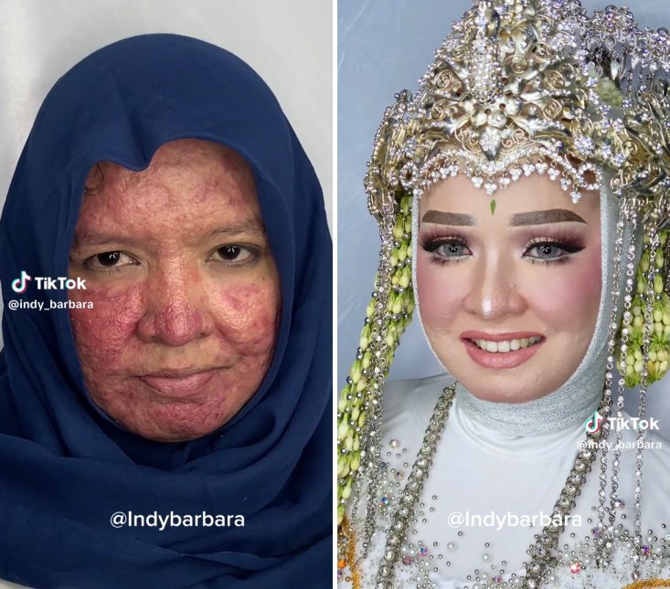 makeup jerawat parah © TikTok