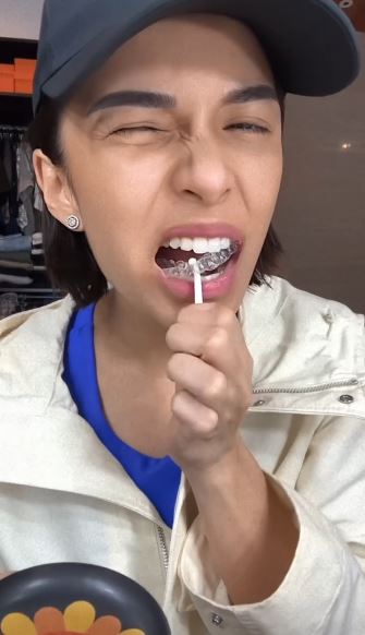 11 Penampilan gigi baru Chelsea Olivia, warganet heboh bandingkan penampilannya yang dulu 
