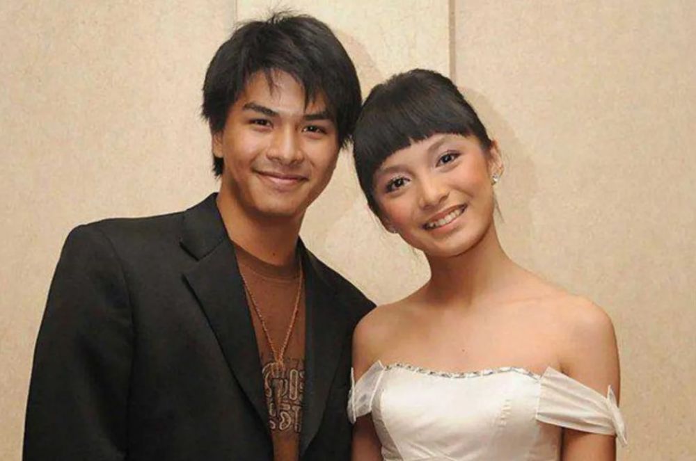 transformasi Chelsea Olivia gigi gingsul © berbagai sumber