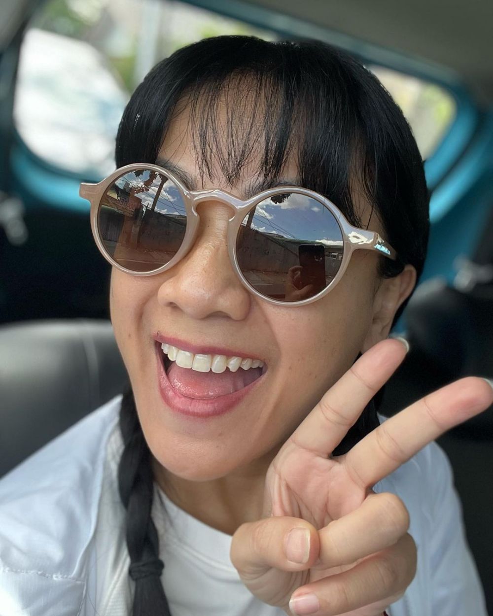 penampilan baru seleb usai hilangkan gigi gingsul © berbagai sumber