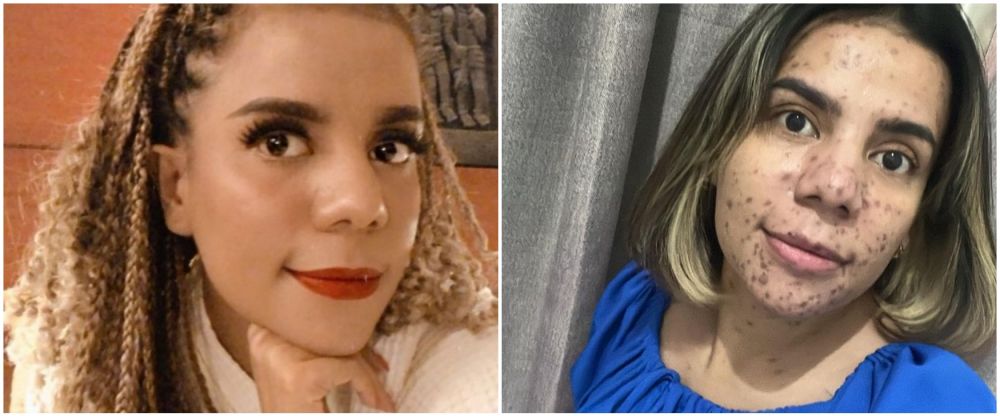 Nowela pakai makeup vs tanpa makeup © Instagram