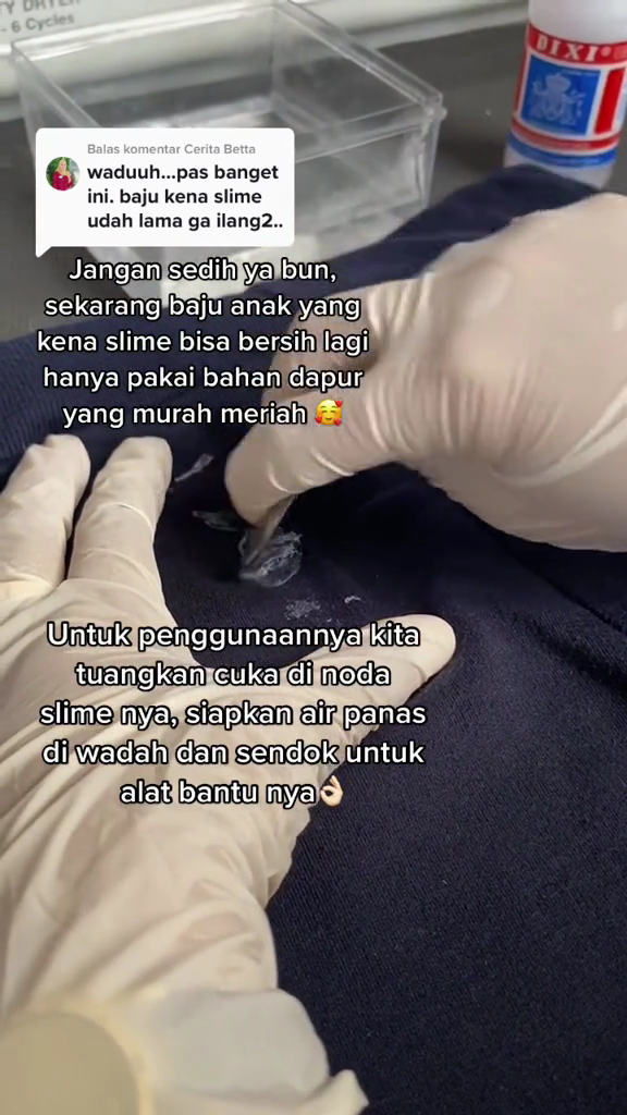 Bukan pakai minyak goreng, ini cara mudah hilangkan noda getah di pakaian dengan 1 bahan dapur