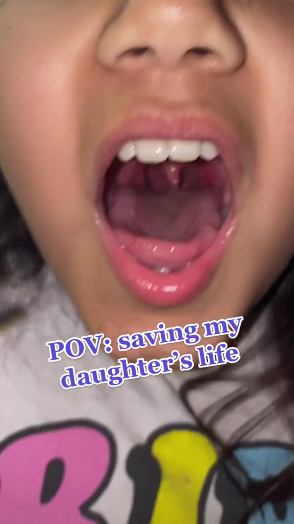 Bukan menelan nasi, aksi wanita mengeluarkan duri ikan di tenggorokan ini ampuhnya bikin melongo