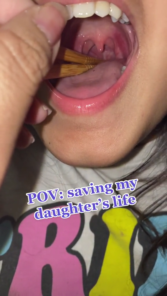 Bukan menelan nasi, aksi wanita mengeluarkan duri ikan di tenggorokan ini ampuhnya bikin melongo