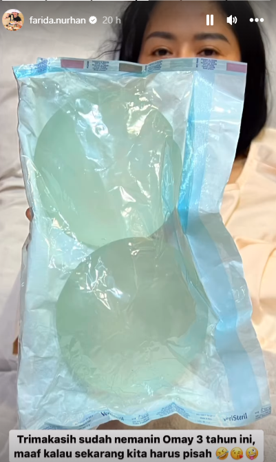 Kondisi Farida Nurhan usai jalani operasi pengangkatan payudara © 2023 brilio.net