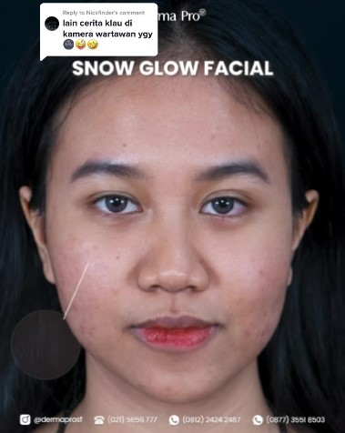 wajah Mayang tanpa filter © TikTok