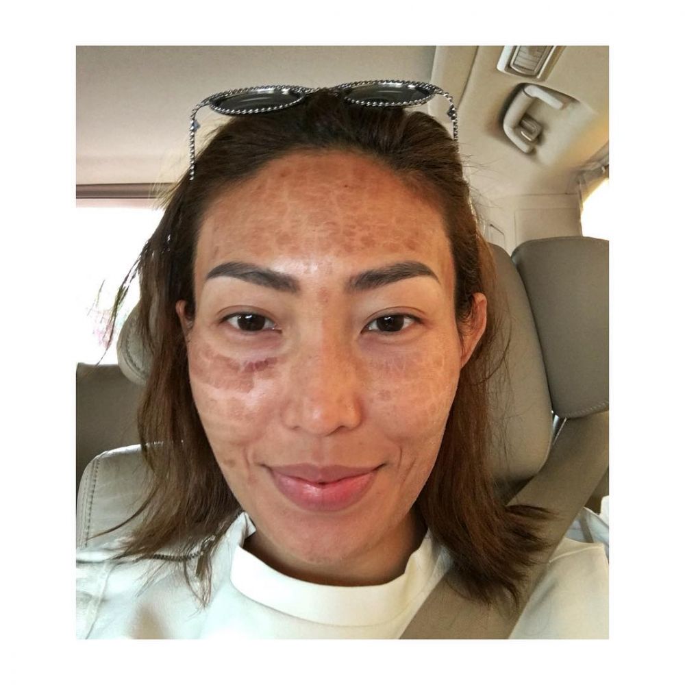 potret presenter wanita pede tampil dengan wajah tak mulus © berbagai sumber potret presenter wanita pede tampil dengan wajah tak mulus © berbagai sumber