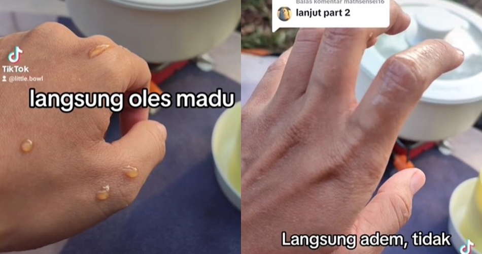 Tanpa pasta gigi, ini trik atasi kulit terkena minyak panas agar tak berbekas dengan 1 bahan dapur