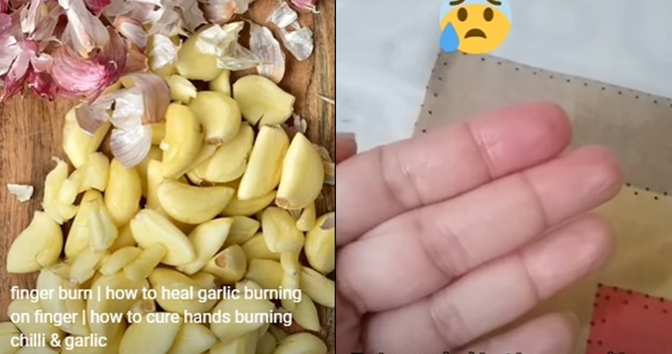 Pakai tambahan 1 bahan dapur, ini cara redakan rasa panas di jari usai memotong cabai dan bawang putih