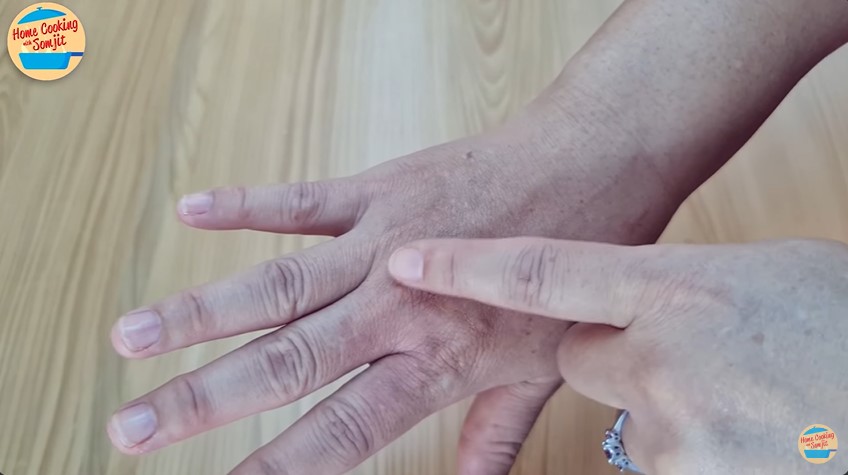 Bukan pakai garam atau pasta gigi, ini trik mengatasi kulit tersiram air panas dengan 1 bahan dapur