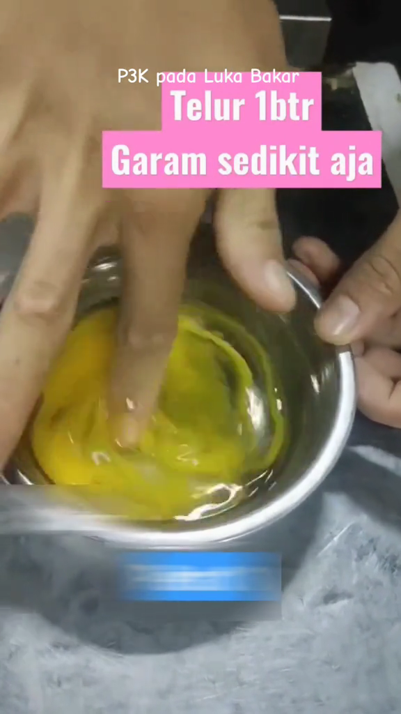 Cara atasi kulit yang terkena minyak panas agar tak melepuh dan berbekas pakai 2 bahan dapur
