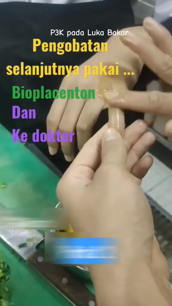 Cara atasi kulit yang terkena minyak panas agar tak melepuh dan berbekas pakai 2 bahan dapur