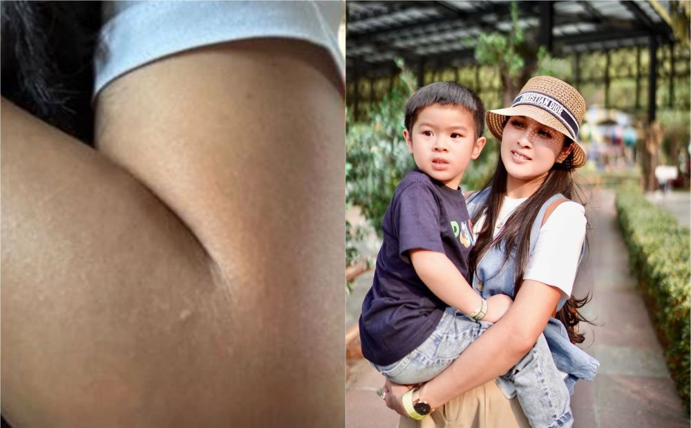 Seleb ini pede pamerkan badan belang usai pulang liburan © 2023 brilio.net Seleb ini pede pamerkan badan belang usai pulang liburan © 2023 brilio.net