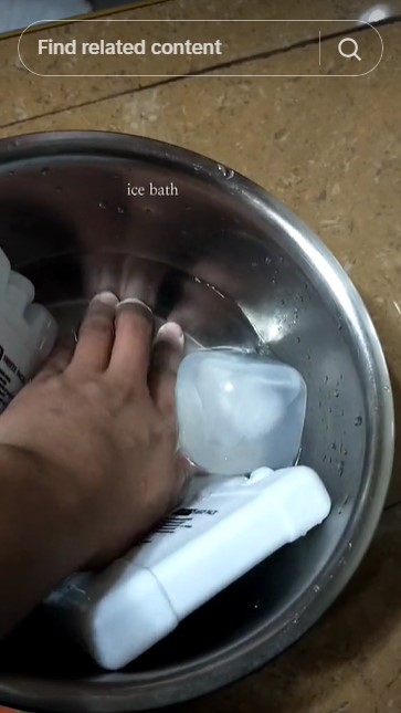 Tanpa pasta gigi, ini trik atasi kulit kena air atau minyak panas biar tak melepuh pakai 1 bahan dapur