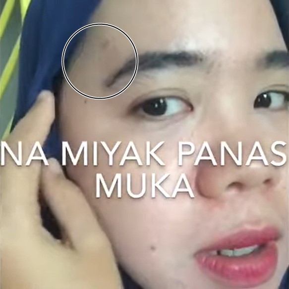 Trik mengatasi kulit wajah yang terciprat minyak panas supaya tak melepuh pakai 1 bahan dapur