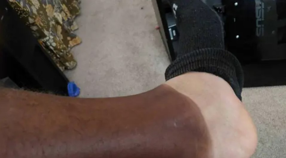 Potret lucu kulit belang nggak ketolong Berbagai sumber Potret lucu kulit belang nggak ketolong Berbagai sumber