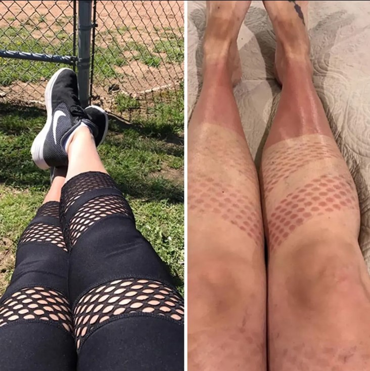 Potret lucu kulit belang nggak ketolong Berbagai sumber Potret lucu kulit belang nggak ketolong Berbagai sumber