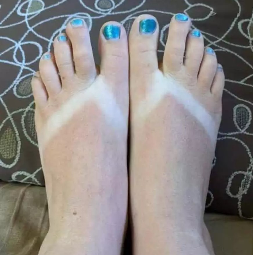 Potret lucu kulit belang nggak ketolong Berbagai sumber Potret lucu kulit belang nggak ketolong Berbagai sumber