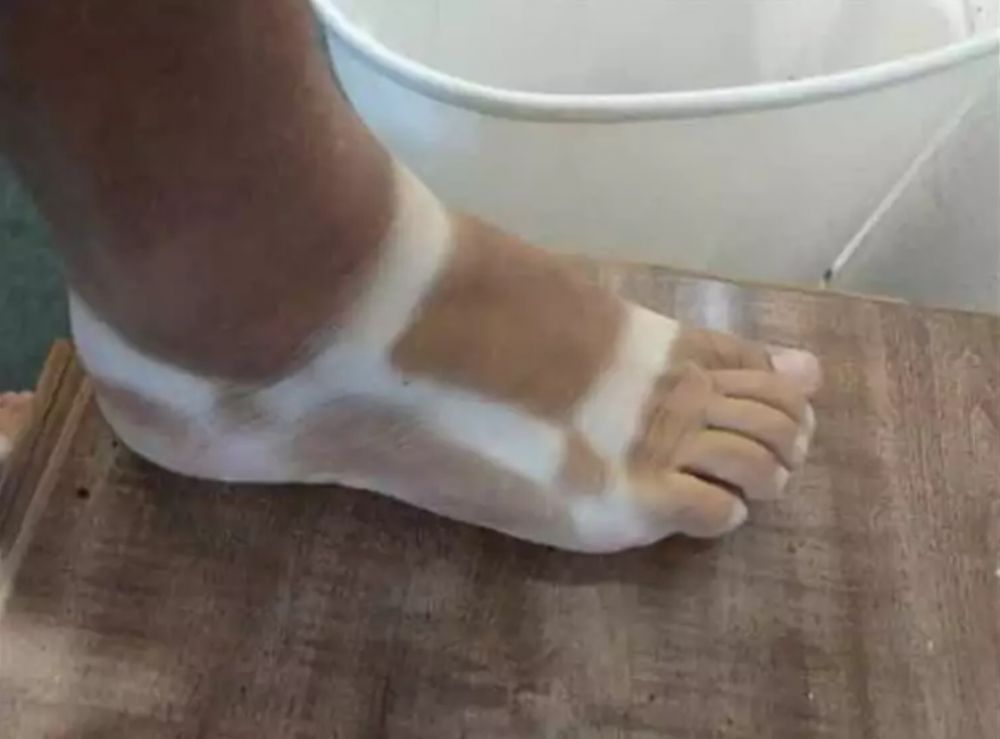 Potret lucu kulit belang nggak ketolong Berbagai sumber Potret lucu kulit belang nggak ketolong Berbagai sumber