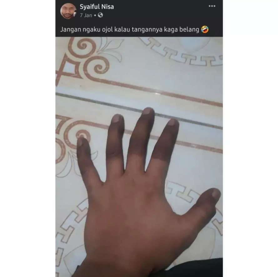 Potret lucu kulit belang nggak ketolong Berbagai sumber Potret lucu kulit belang nggak ketolong Berbagai sumber