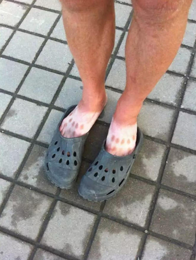 Potret lucu kulit belang nggak ketolong Berbagai sumber Potret lucu kulit belang nggak ketolong Berbagai sumber