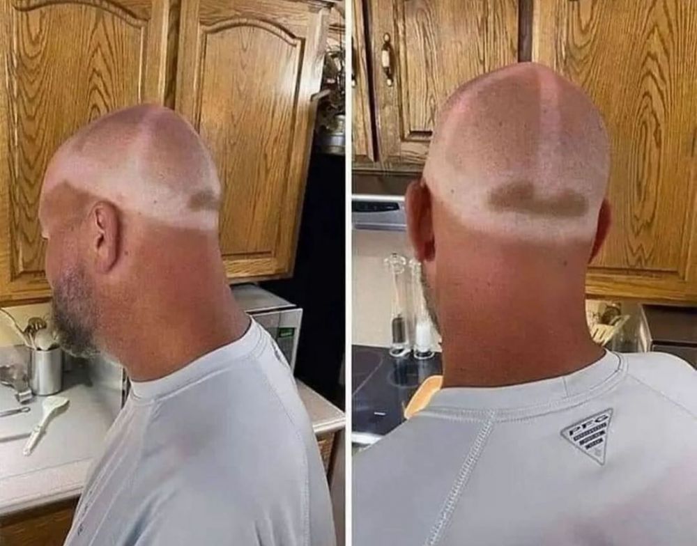 Potret lucu kulit belang nggak ketolong Berbagai sumber Potret lucu kulit belang nggak ketolong Berbagai sumber