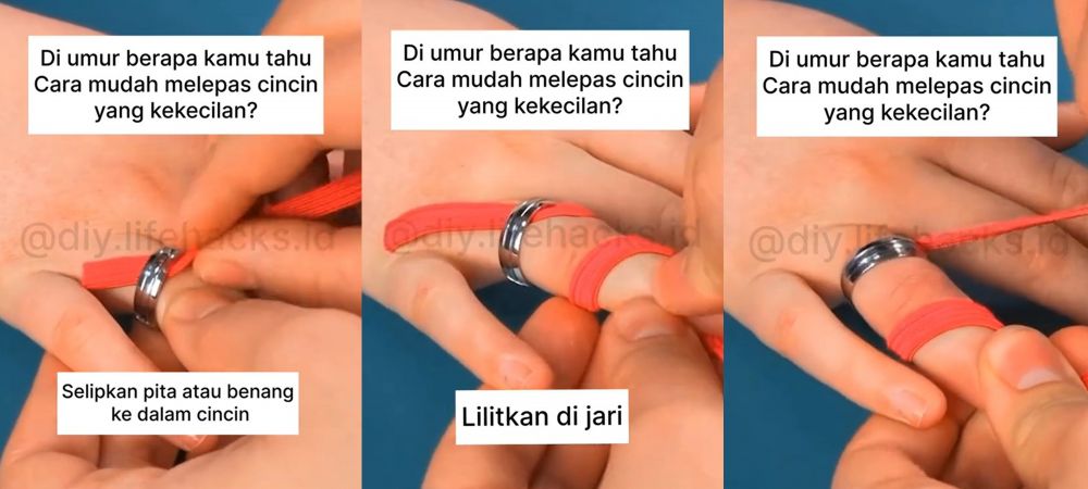 cara mudah melepas cincin yang kekecilan pakai 1 jenis alat © berbagai sumber
