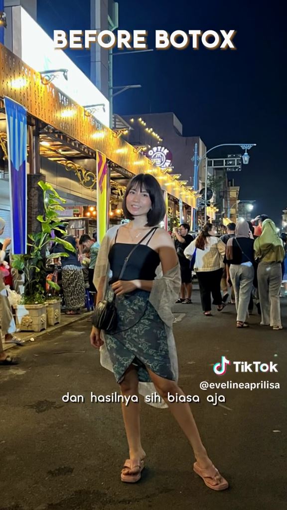 gagal botox © TikTok gagal botox © TikTok