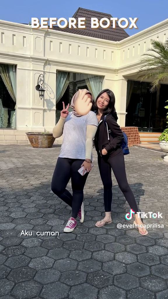 gagal botox © TikTok gagal botox © TikTok