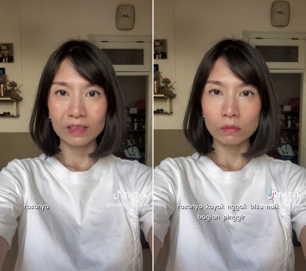 gagal botox © TikTok gagal botox © TikTok