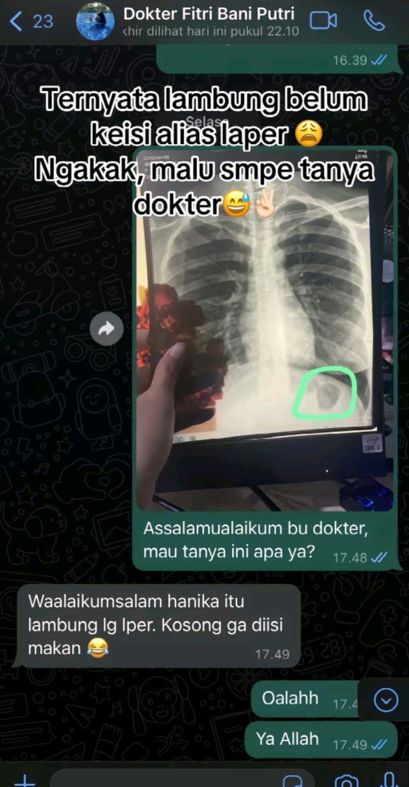 rontgen malu © TikTok