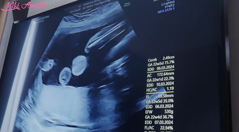 Kiki Amalia ungkap jenis kelamin anak pertama © YouTube