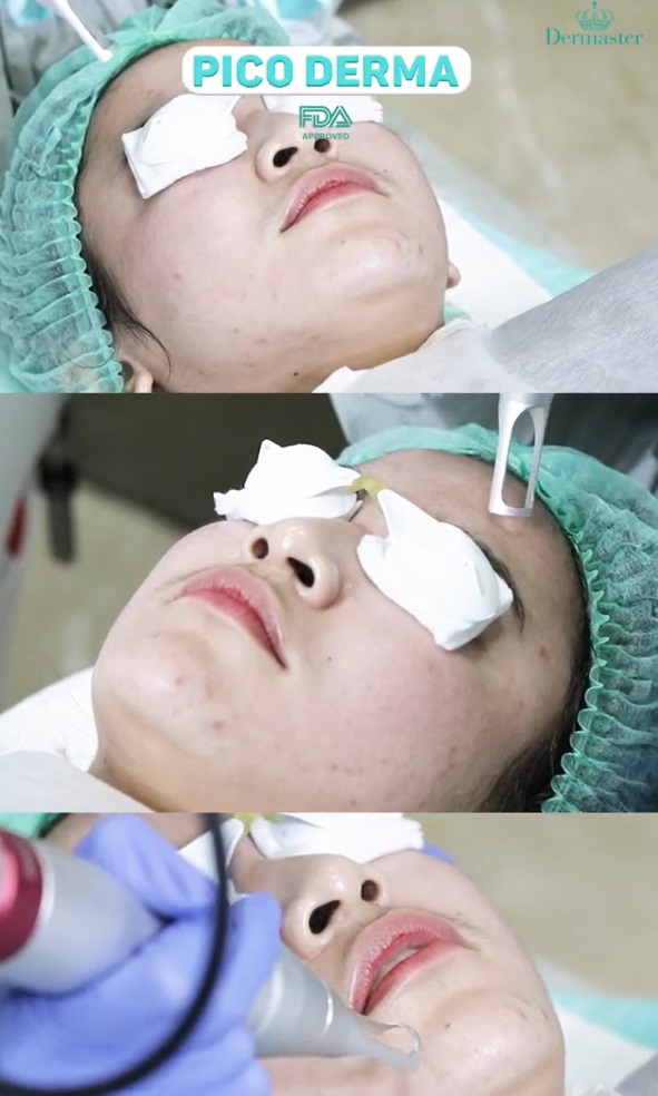 pesona mahalini tampil polosan tanpa riasan © berbagai sumber