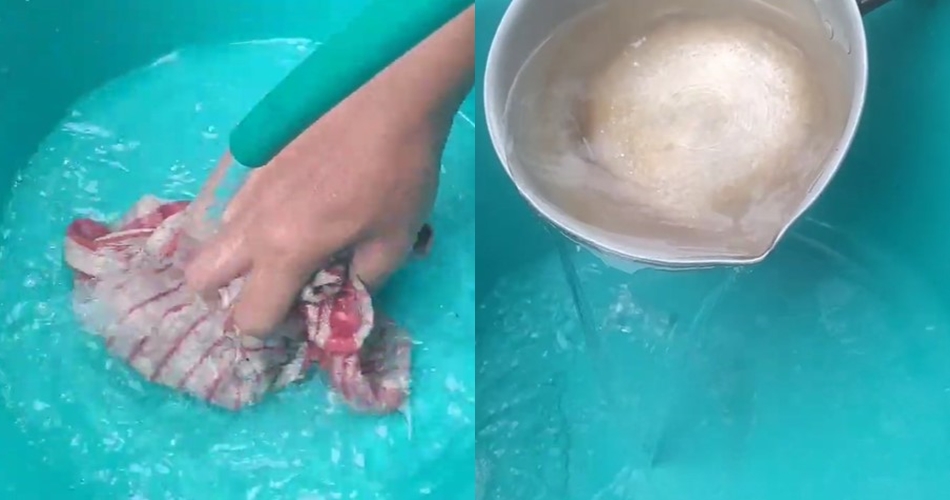 Tanpa sitrun ataupun cuka, ini cara mencuci serbet dapur dekil jadi bersih lagi pakai 2 bahan dapur