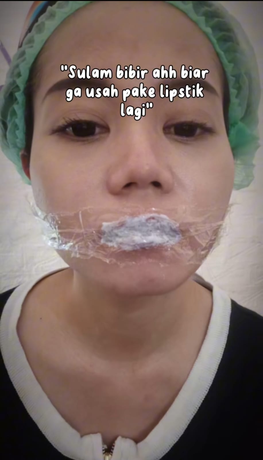 sulam bibir bengkak © TikTok