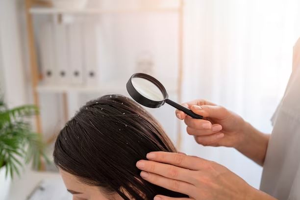 Arti mimpi banyak kutu di kepala freepik.com