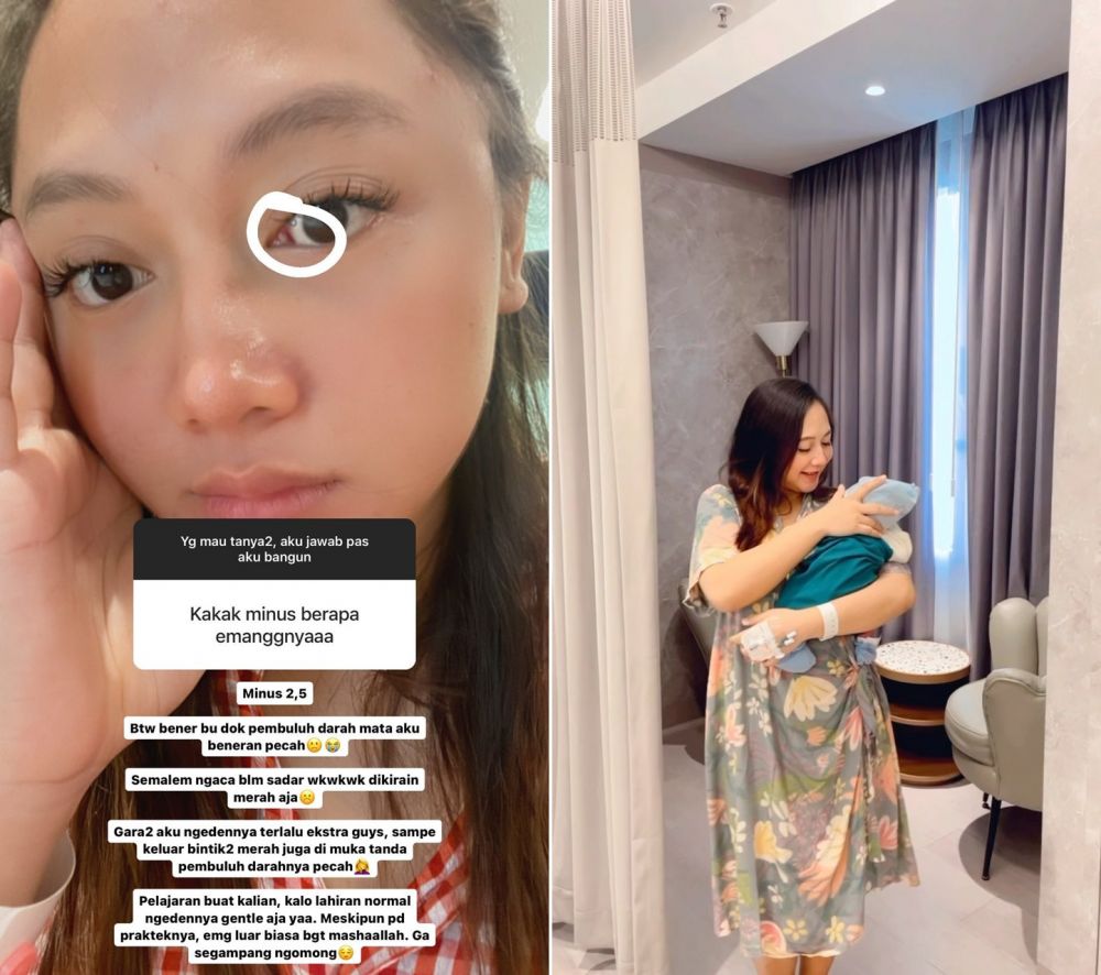 artis alami masalah kesehatan usai melahirkan © Instagram