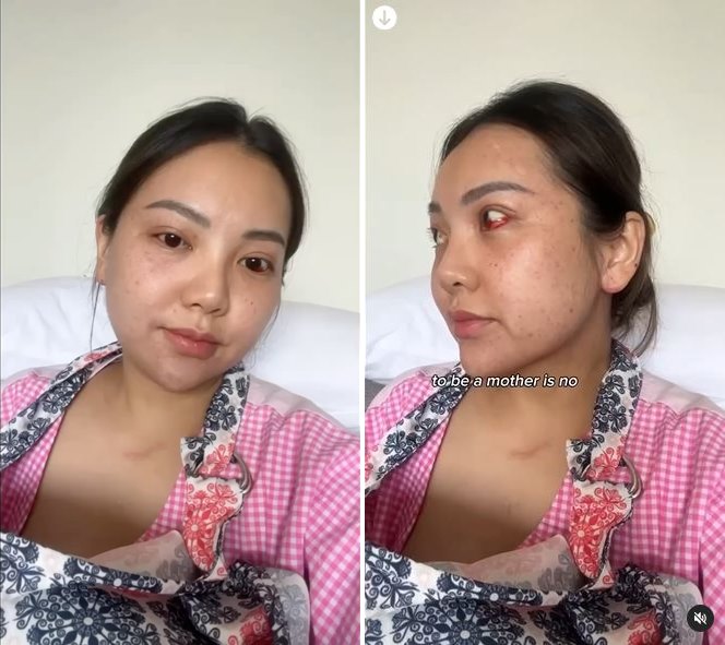 artis alami masalah kesehatan usai melahirkan © Instagram