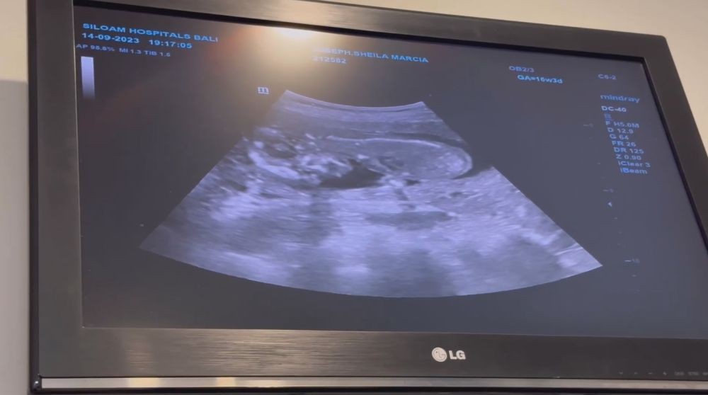 momen perjalanan kehamilan sheila marcia © berbagai sumber